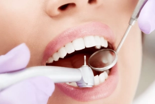 Dental fillings help restore teeth damaged by cavities with durable, natural-looking materials.