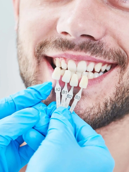 Dantah Dental Care offers advanced dental treatment for personalized smile correction for a confident smile.